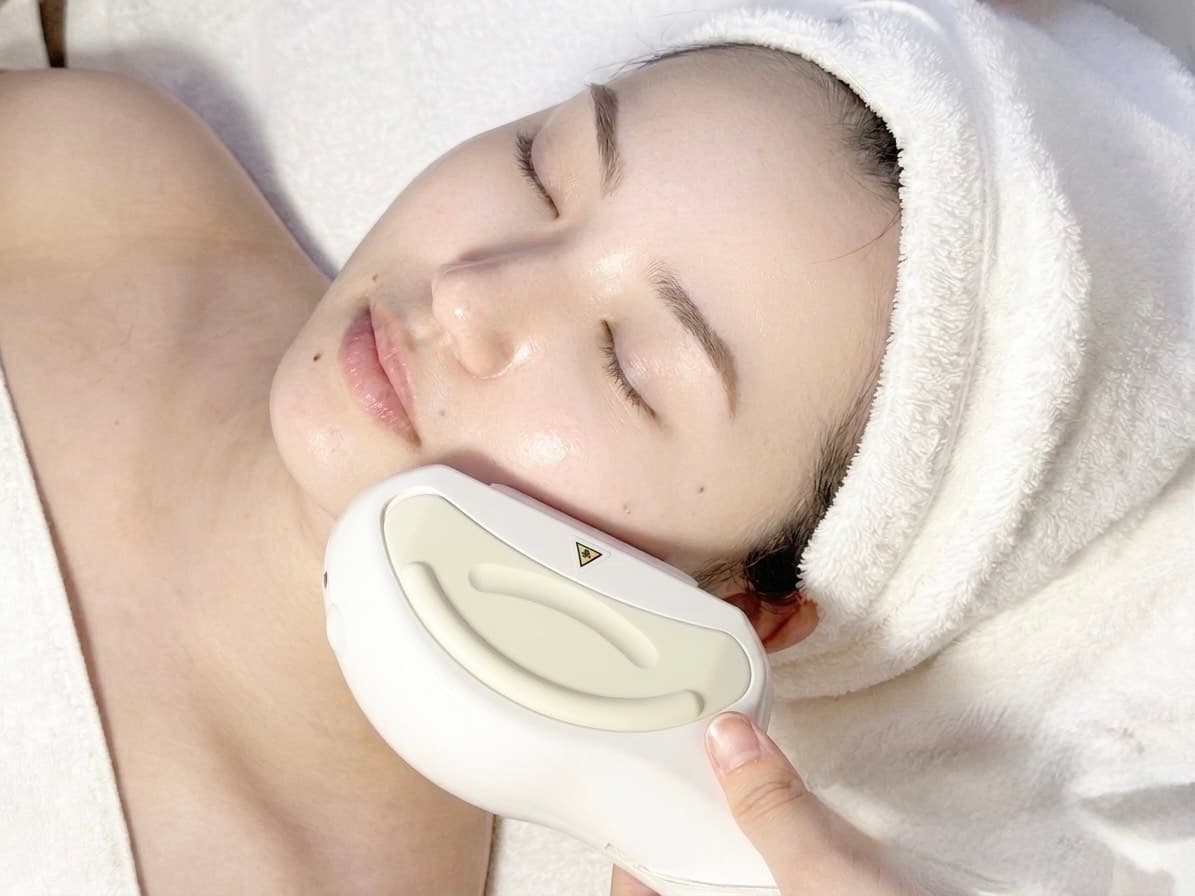 美白・シミ・くすみの施術イメージ